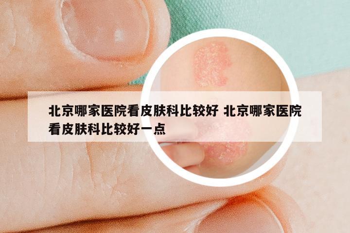 北京哪家医院看皮肤科比较好 北京哪家医院看皮肤科比较好一点