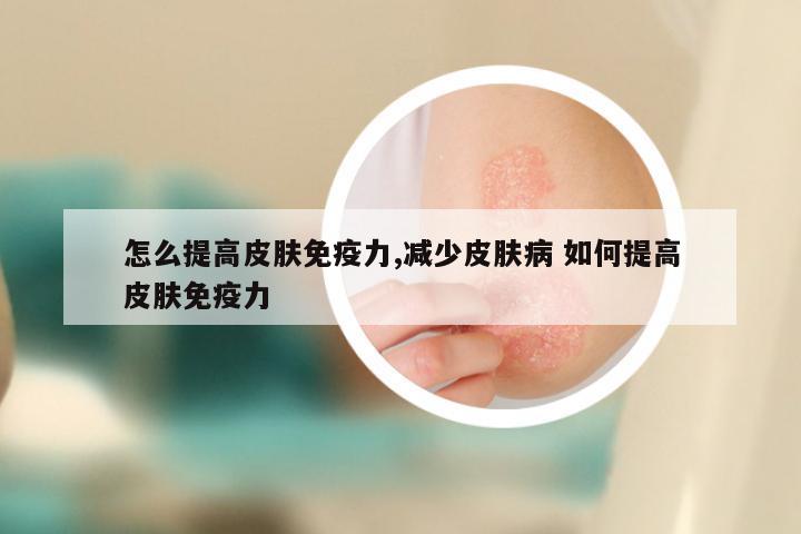 怎么提高皮肤免疫力,减少皮肤病 如何提高皮肤免疫力