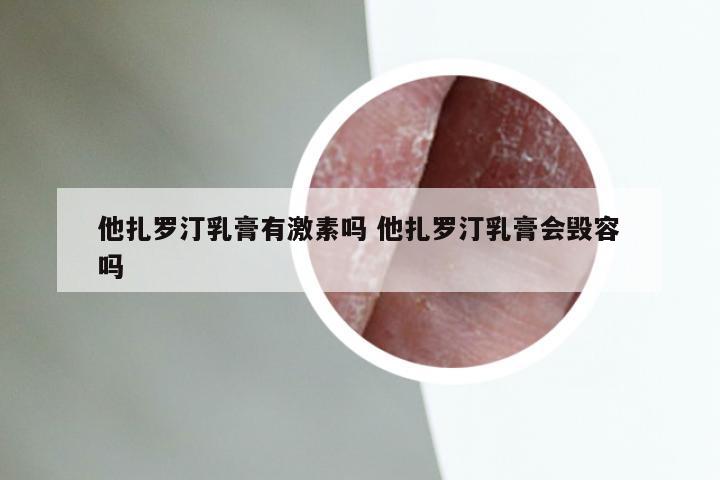 他扎罗汀乳膏有激素吗 他扎罗汀乳膏会毁容吗