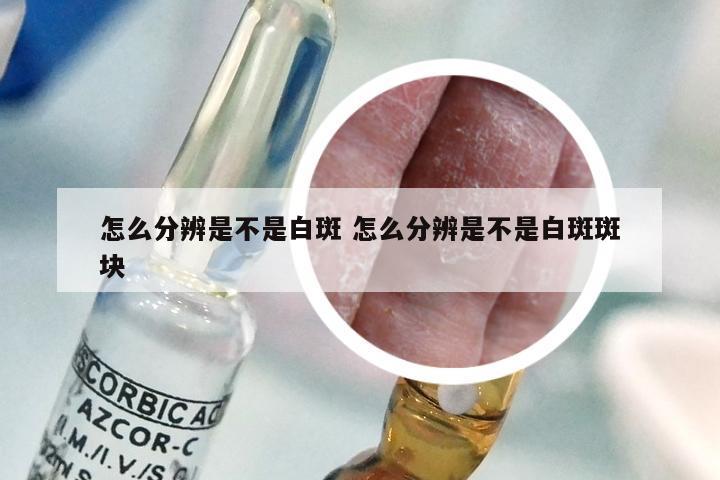 怎么分辨是不是白斑 怎么分辨是不是白斑斑块