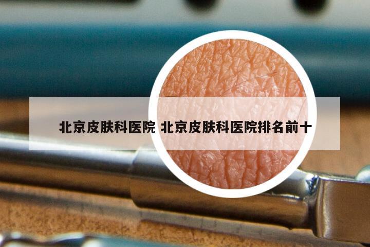 北京皮肤科医院 北京皮肤科医院排名前十