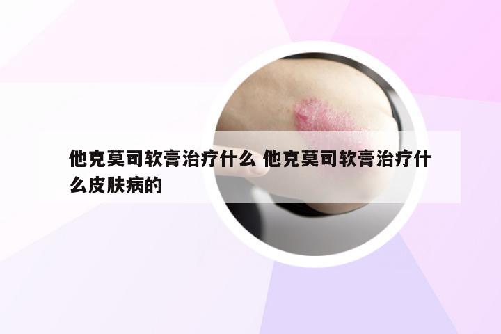 他克莫司软膏治疗什么 他克莫司软膏治疗什么皮肤病的