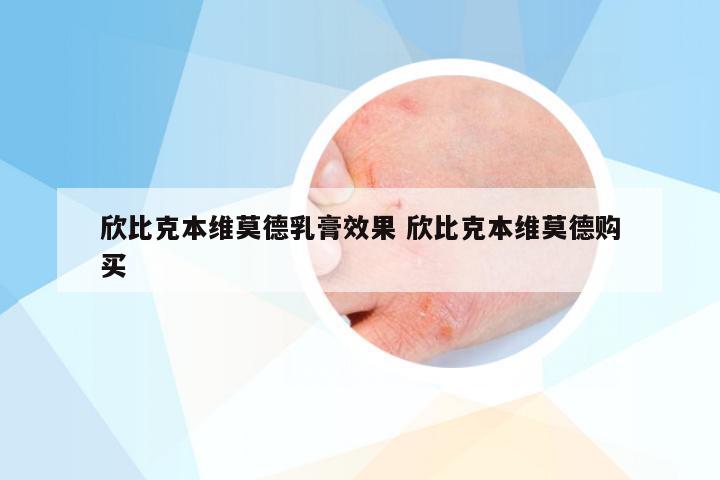 欣比克本维莫德乳膏效果 欣比克本维莫德购买