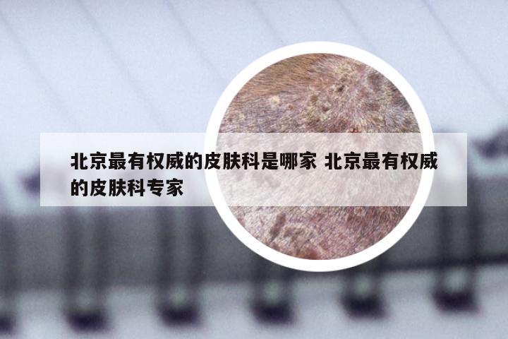 北京最有权威的皮肤科是哪家 北京最有权威的皮肤科专家