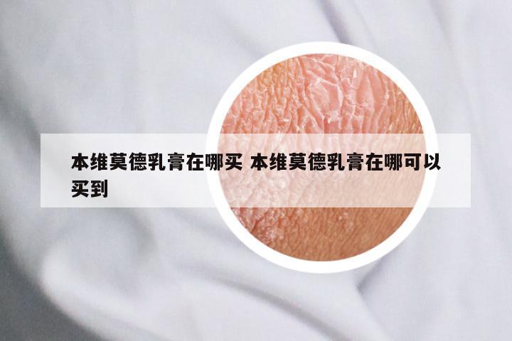 本维莫德乳膏在哪买 本维莫德乳膏在哪可以买到