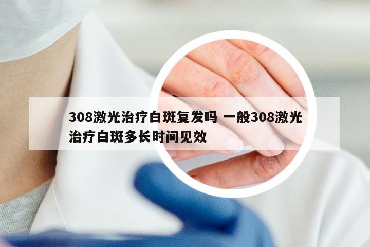 308激光治疗白斑复发吗 一般308激光治疗白斑多长时间见效