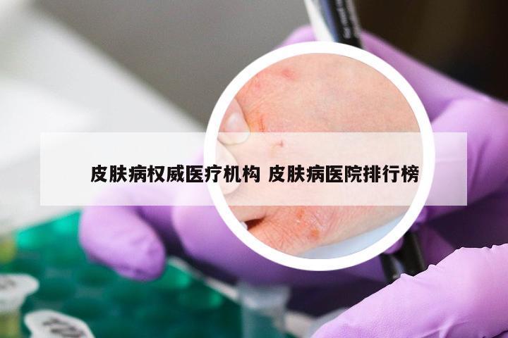 皮肤病权威医疗机构 皮肤病医院排行榜