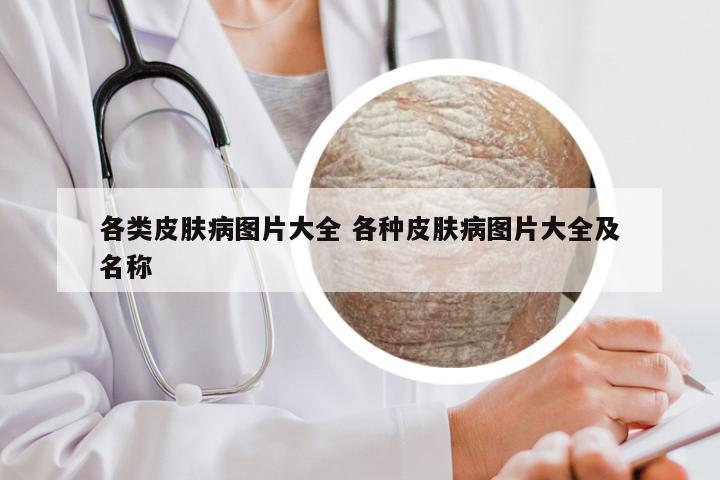 各类皮肤病图片大全 各种皮肤病图片大全及名称