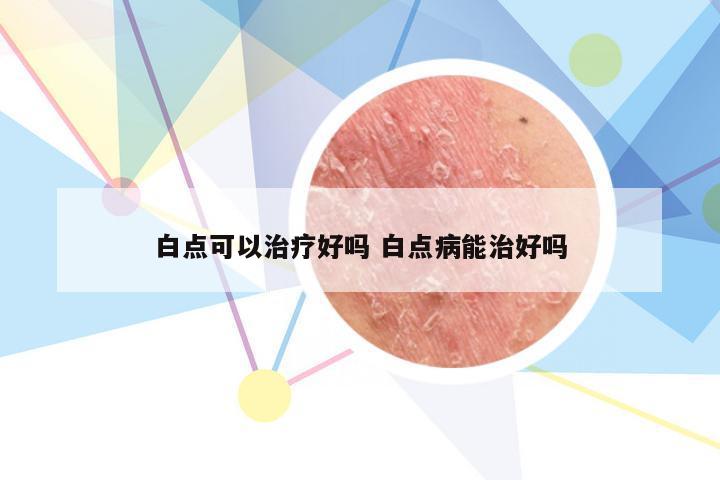 白点可以治疗好吗 白点病能治好吗