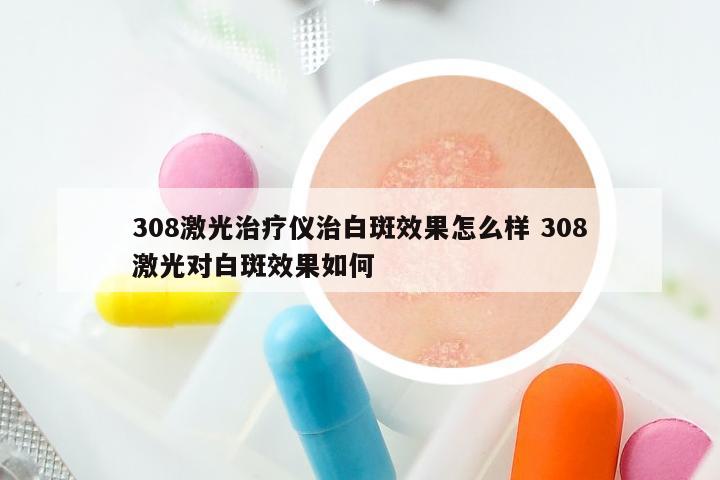 308激光治疗仪治白斑效果怎么样 308激光对白斑效果如何