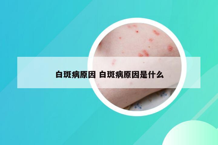 白斑病原因 白斑病原因是什么