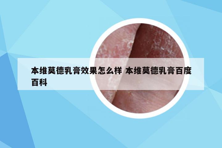 本维莫德乳膏效果怎么样 本维莫德乳膏百度百科