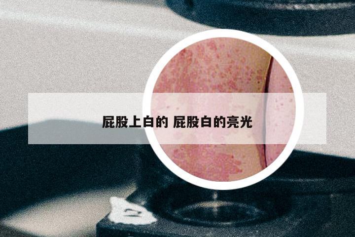 屁股上白的 屁股白的亮光