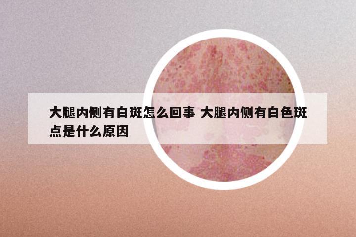 大腿内侧有白斑怎么回事 大腿内侧有白色斑点是什么原因