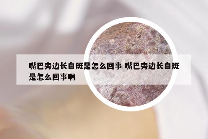 嘴巴旁边长白斑是怎么回事 嘴巴旁边长白斑是怎么回事啊