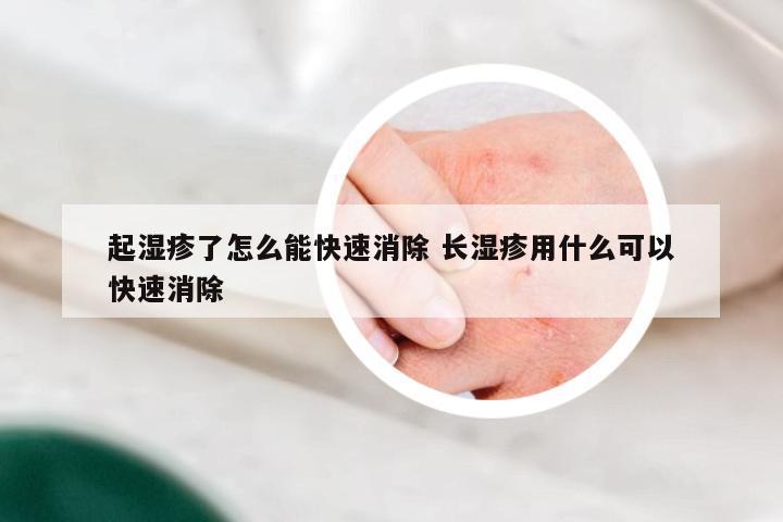 起湿疹了怎么能快速消除 长湿疹用什么可以快速消除