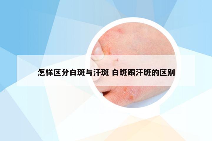 怎样区分白斑与汗斑 白斑跟汗斑的区别