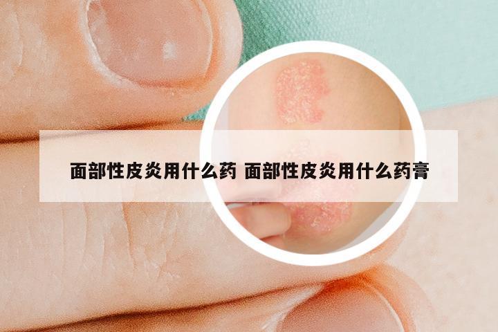 面部性皮炎用什么药 面部性皮炎用什么药膏