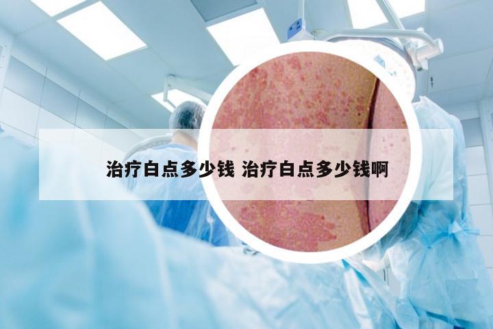 治疗白点多少钱 治疗白点多少钱啊