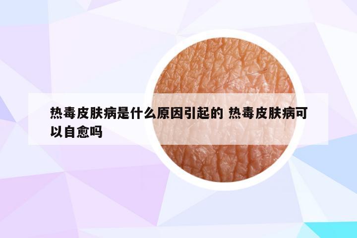 热毒皮肤病是什么原因引起的 热毒皮肤病可以自愈吗