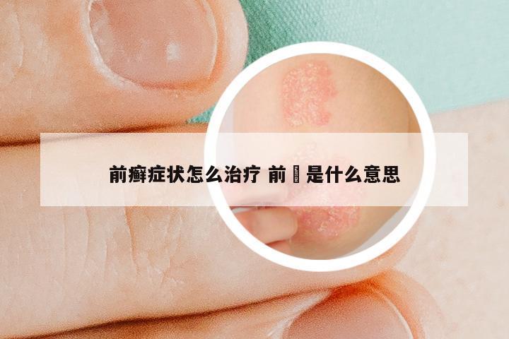 前癣症状怎么治疗 前臵是什么意思