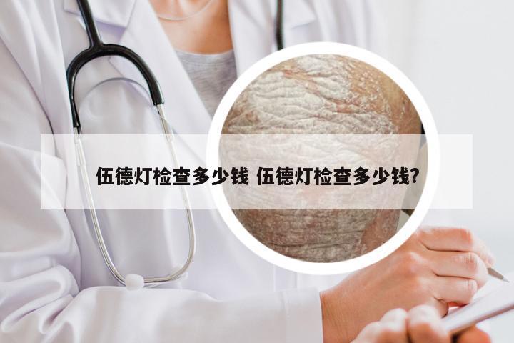 伍德灯检查多少钱 伍德灯检查多少钱?