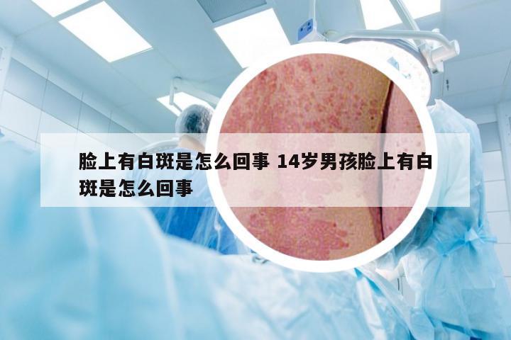 脸上有白斑是怎么回事 14岁男孩脸上有白斑是怎么回事