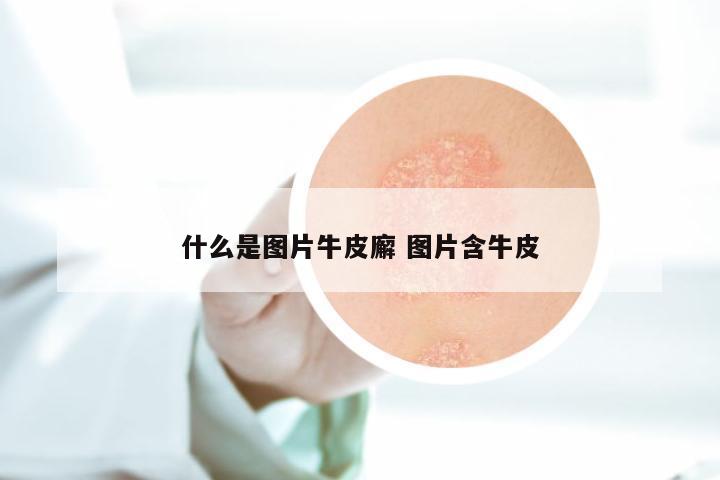 什么是图片牛皮廨 图片含牛皮