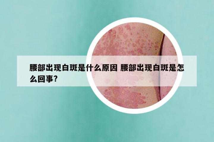 腰部出现白斑是什么原因 腰部出现白斑是怎么回事?