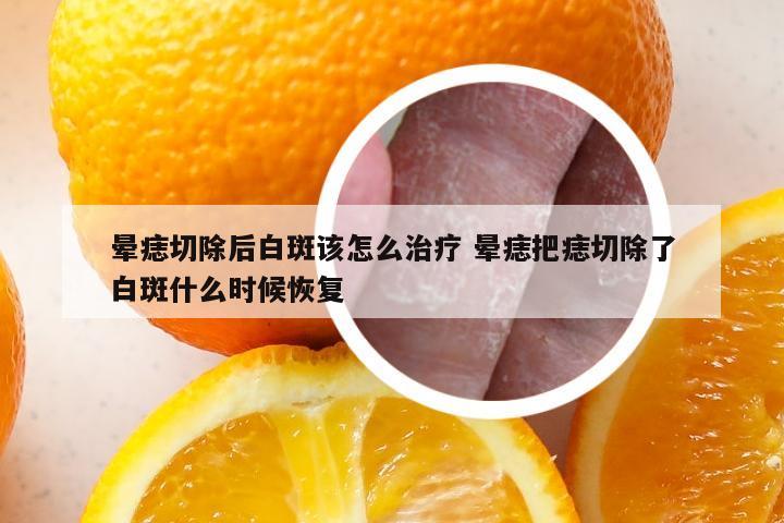 晕痣切除后白斑该怎么治疗 晕痣把痣切除了白斑什么时候恢复