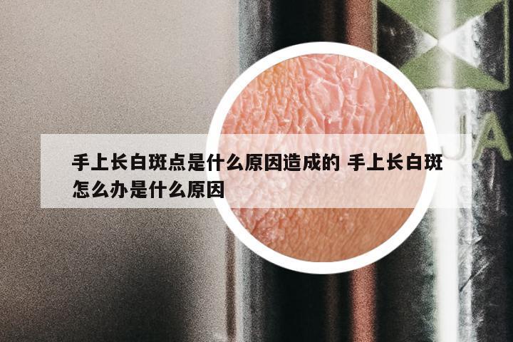 手上长白斑点是什么原因造成的 手上长白斑怎么办是什么原因