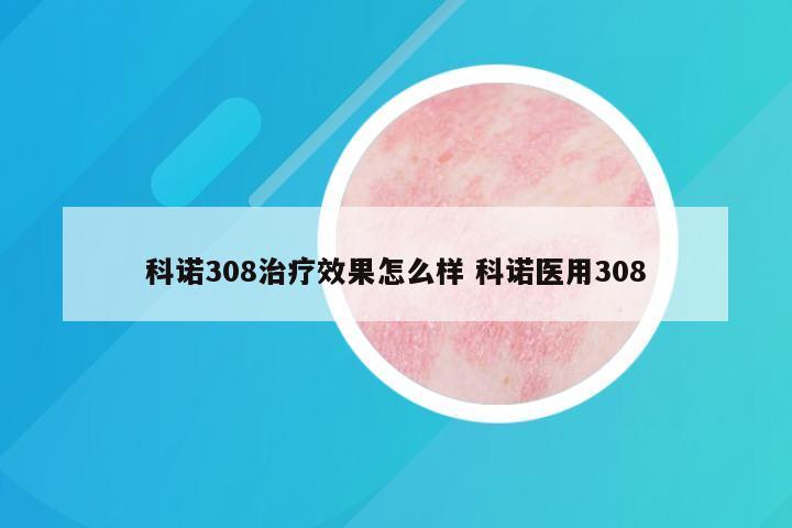 科诺308治疗效果怎么样 科诺医用308