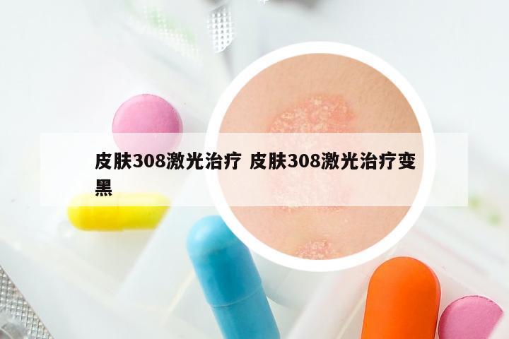 皮肤308激光治疗 皮肤308激光治疗变黑