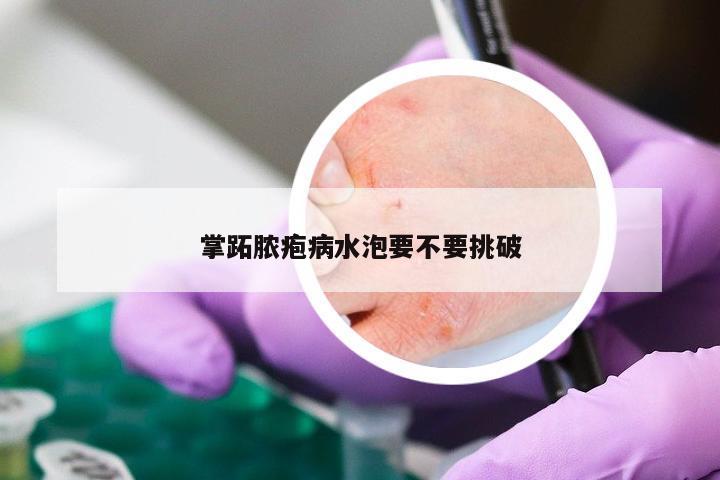 掌跖脓疱病水泡要不要挑破