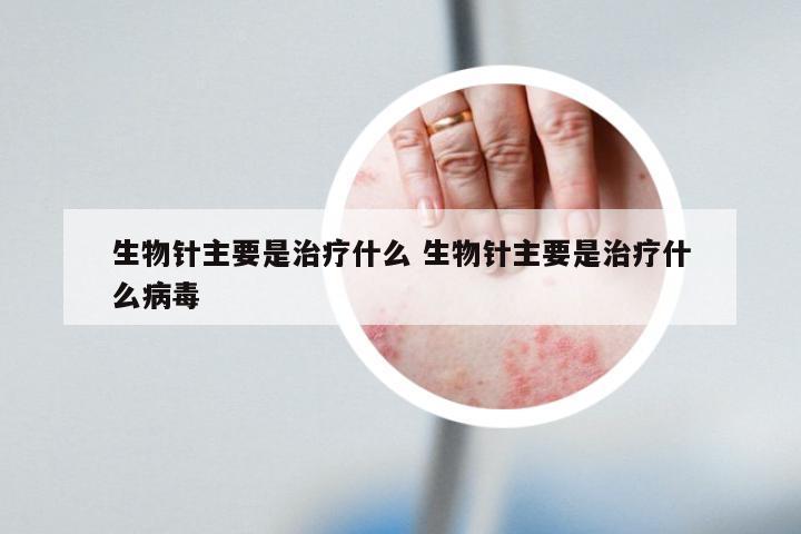 生物针主要是治疗什么 生物针主要是治疗什么病毒