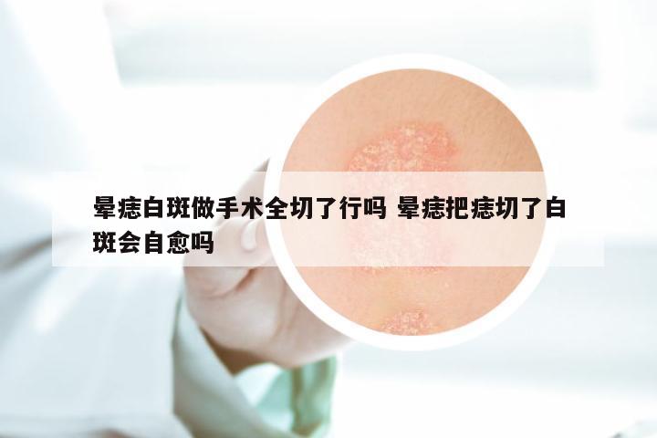 晕痣白斑做手术全切了行吗 晕痣把痣切了白斑会自愈吗