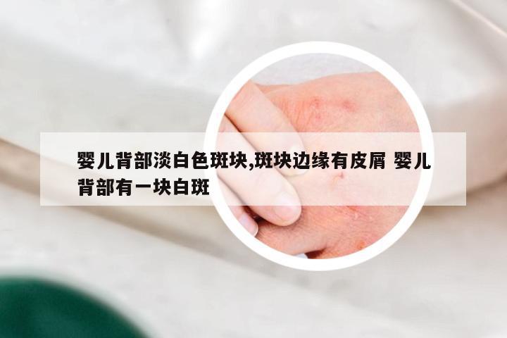 婴儿背部淡白色斑块,斑块边缘有皮屑 婴儿背部有一块白斑