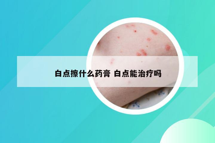 白点擦什么药膏 白点能治疗吗