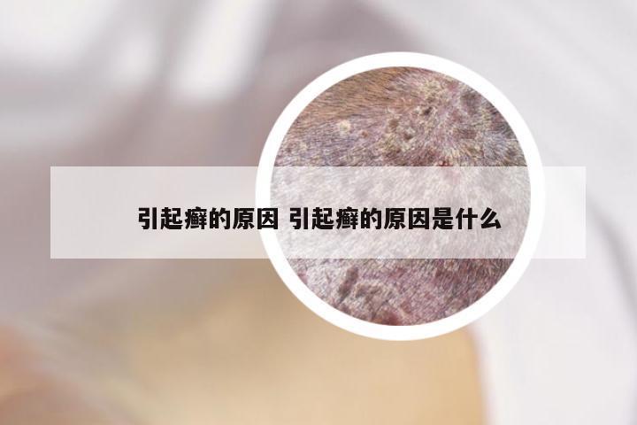 引起癣的原因 引起癣的原因是什么