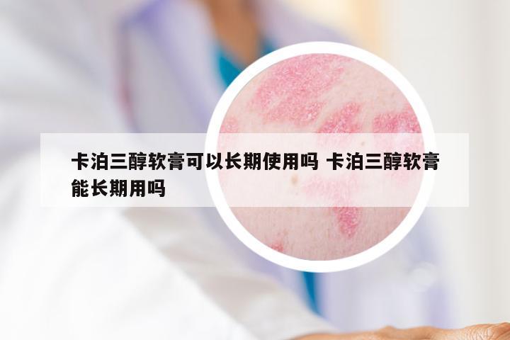 卡泊三醇软膏可以长期使用吗 卡泊三醇软膏能长期用吗