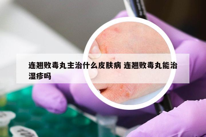 连翘败毒丸主治什么皮肤病 连翘败毒丸能治湿疹吗