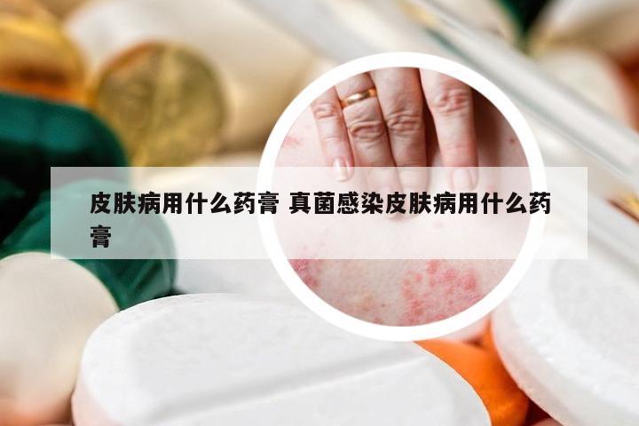 皮肤病用什么药膏 真菌感染皮肤病用什么药膏