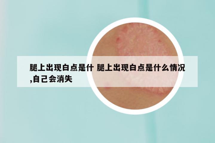 腿上出现白点是什 腿上出现白点是什么情况,自己会消失