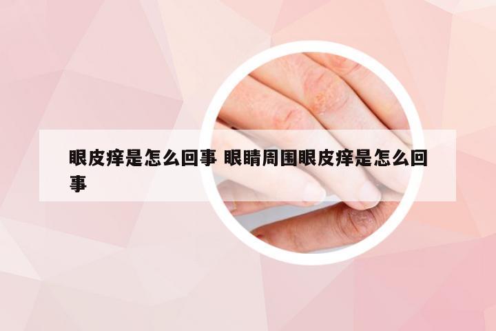 眼皮痒是怎么回事 眼睛周围眼皮痒是怎么回事