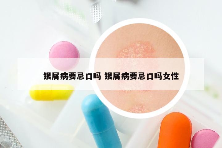 银屑病要忌口吗 银屑病要忌口吗女性