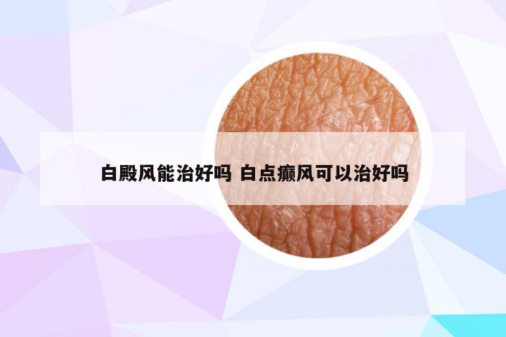 白殿风能治好吗 白点癫风可以治好吗