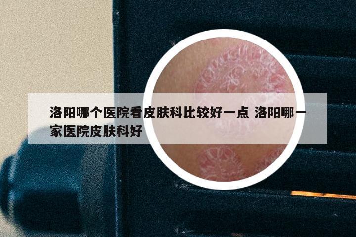 洛阳哪个医院看皮肤科比较好一点 洛阳哪一家医院皮肤科好