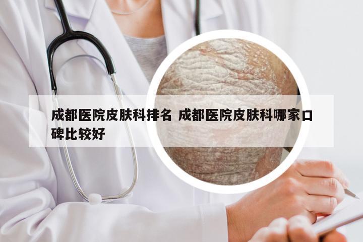 成都医院皮肤科排名 成都医院皮肤科哪家口碑比较好