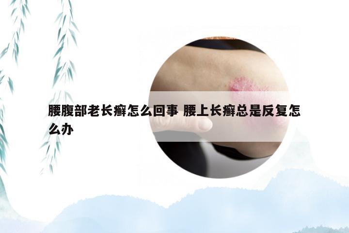 腰腹部老长癣怎么回事 腰上长癣总是反复怎么办