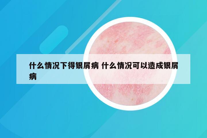 什么情况下得银屑病 什么情况可以造成银屑病